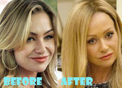 Portia De Rossi Plastic Surgery Before and After Nose Job