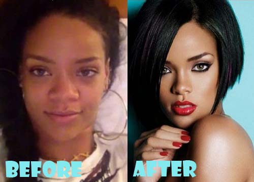 Rihanna Plastic Surgery Before and After Nose Job