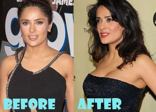 Salma Hayek Plastic Surgery Before and After Pictures