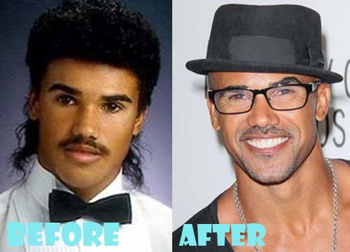 Shemar Moore Plastic Surgery