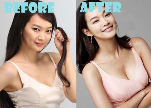 Shin Min Ah Plastic Surgery Before and After Photos