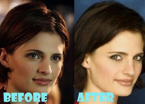 Stana Katic Plastic Surgery Before and After Nose Job