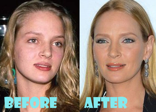Uma Thurman Plastic Surgery Before and After Picture