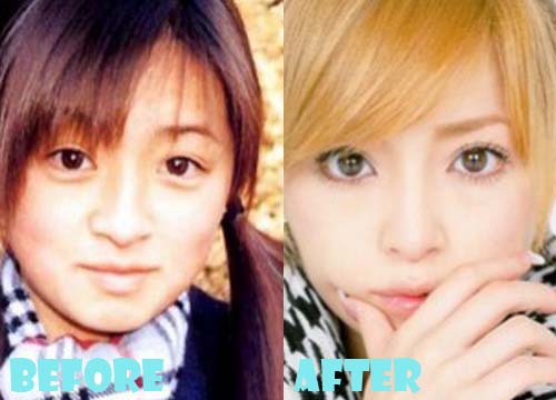 Ayumi Hamasaki Plastic Surgery Before and After Pictures
