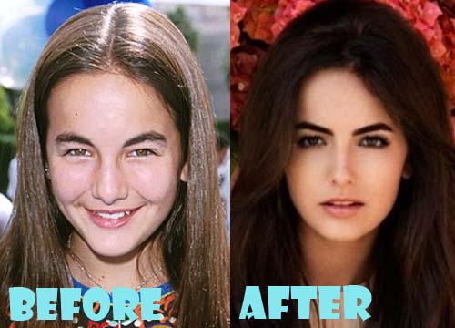 Camilla Belle Plastic Surgery Before and After Nose Job