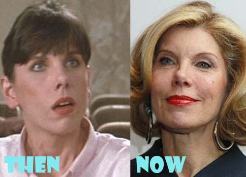 Christine Baranski Plastic Surgery Before and After Photos
