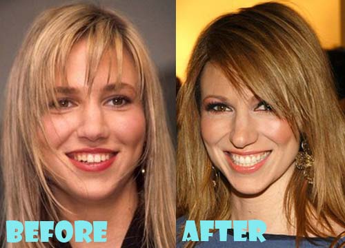 Debbie Gibson Plastic Surgery Before and After Pictures