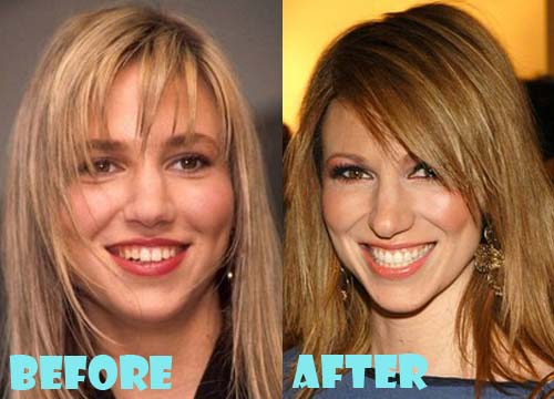 Debbie Gibson Plastic Surgery Nose Job