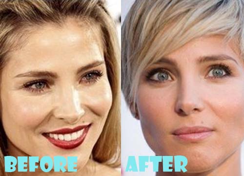 Elsa Pataky Plastic Surgery Before and After Nose Job