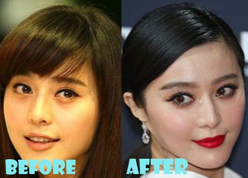 Fan Bingbing Plastic Surgery Before and After Photos