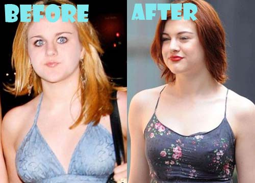 Frances Bean Cobain Plastic Surgery Before and After Photos