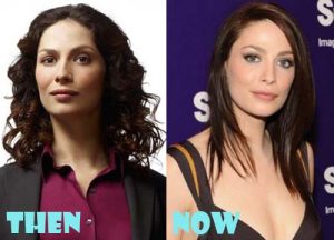 Joanne Kelly Plastic Surgery