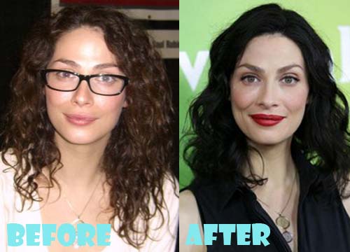 Joanne Kelly Plastic Surgery Before and After Photos