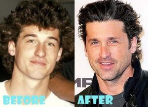 Patrick Dempsey Plastic Surgery Nose Job