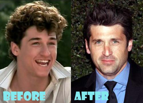 Patrick Dempsey Plastic Surgery Before and After Nose Job