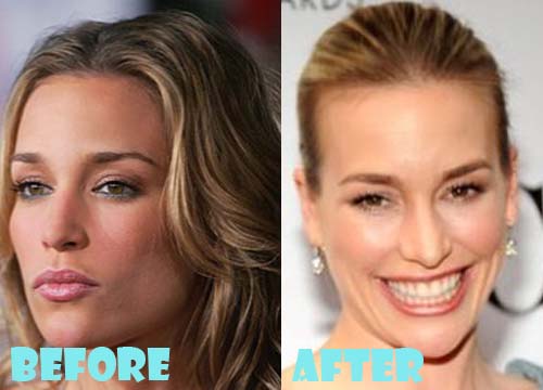 Piper Perabo Plastic Surgery