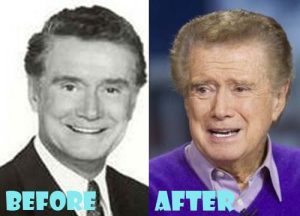 Regis Philbin Plastic Surgery Facelift, Blepharoplasty