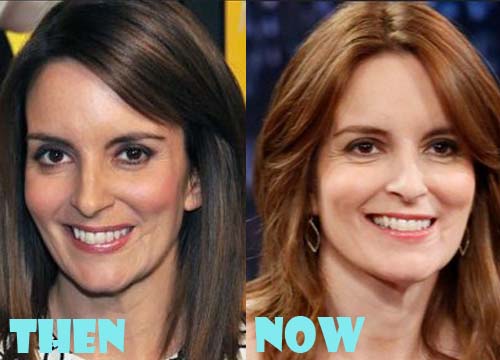 Tina Fey Plastic Surgery Before and After Picture