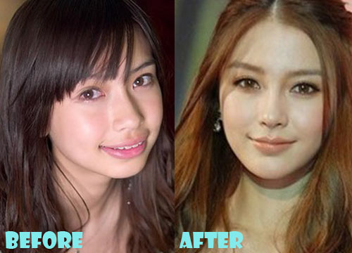 Angelababy Plastic Surgery Before and After Pictures