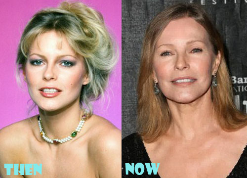 Cheryl Ladd Plastic Surgery