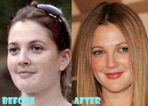 Drew Barrymore Plastic Surgery Nose Job