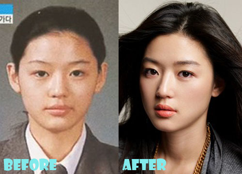 Jun Ji Hyun Plastic Surgery Before and After Nose Job