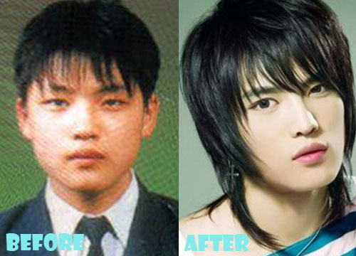 Kim Jaejoong Plastic Surgery Eyelid Surgery