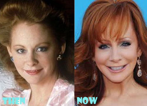 Reba McEntire Plastic Surgery Before After Pictures