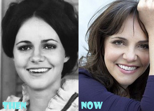 Sally Field Plastic Surgery Before and After Pictures