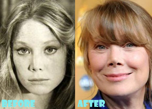 Sissy Spacek Plastic Surgery Before After Nose Job