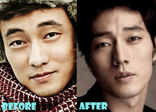 So Ji Sub Plastic Surgery Before and After Nose Job