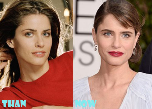 Amanda Peet Plastic Surgery Before and After Botox