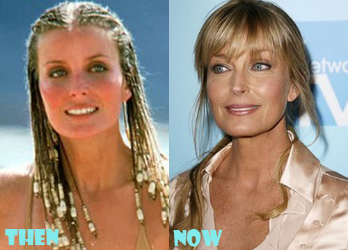 Bo Derek Plastic Surgery Before and After Pictures