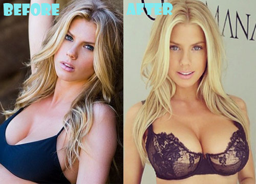 Charlotte McKinney Plastic Surgery Breast Implant