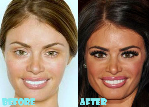Chloe Sims Plastic Surgery Before and After Pictures