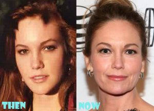 Diane Lane Plastic Surgery Before and After