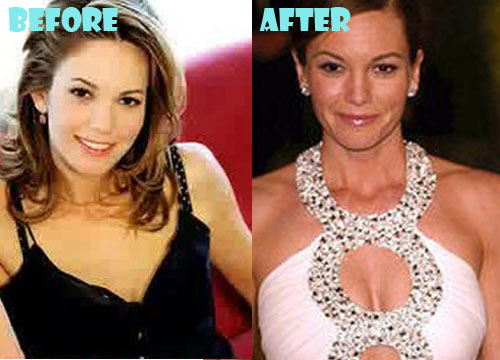 Diane Lane Plastic Surgery Boob Job