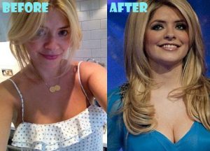 Holly Willoughby Plastic Surgery Breast Implant