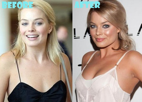Margot Robbie Plastic Surgery Before and After Pictures