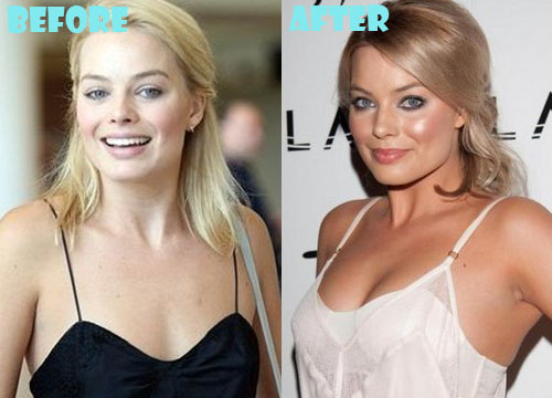 Margot Robbie Plastic Surgery Breast Implant