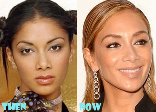 Nicole Scherzinger Plastic Surgery Before and After Pictures