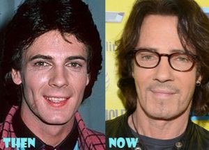 Rick Springfield Plastic Surgery
