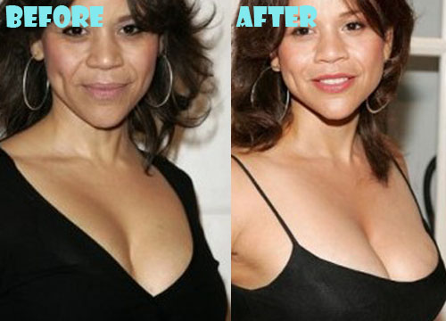 Rosie Perez Plastic Surgery Before and After Pictures
