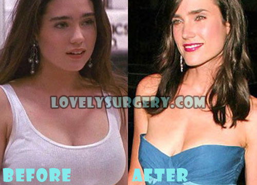 Jennifer Connelly Plastic Surgery Before After Boob Job