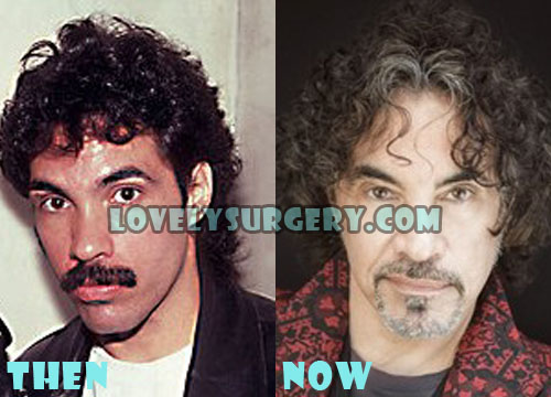 John Oates Plastic Surgery Before and After Photos