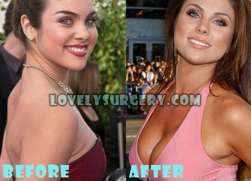 Nadia Bjorlin Plastic Surgery Before and After Photos