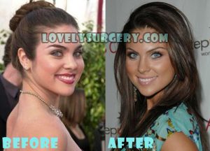 Nadia Bjorlin Plastic Surgery Nose Job