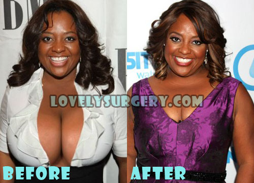 Sherri Shepherd Plastic Surgery Boob Job Before and After.