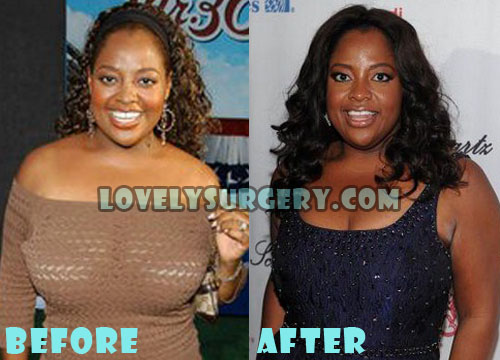 Sherri Shepherd Plastic Surgery Breast Reduction - Lovely Surgery