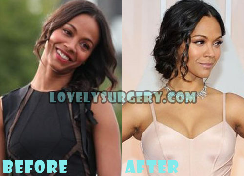 Zoe Saldana Plastic Surgery Before After Boob Job